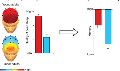 Sleep, Memory and Brain Atrophy