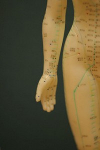 acupuncture for sciatica