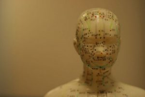 acupuncture treats Parkinson's