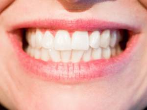 white teeth oral health