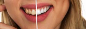 natural foods whiten teeth