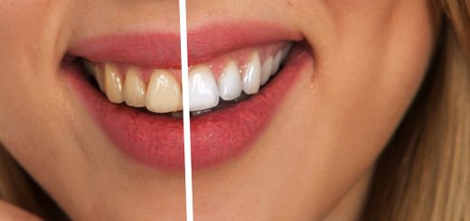 natural foods whiten teeth