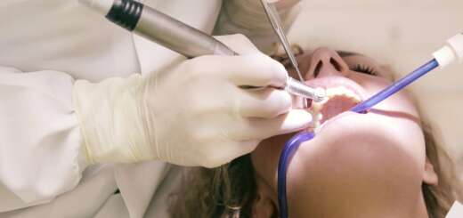 dental extraction and natural care